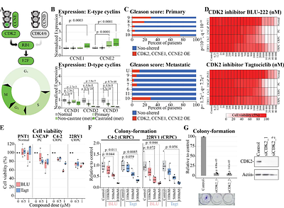 Castration-resistant prostate cancer cells are addicted to the high activity of cyclin-dependent kinase 2
