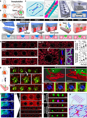 Microengineered transplantation of human solid tumors for in vitro studies of CAR T immunotherapy