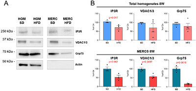Early changes of ER-mitochondrial interaction in the liver of high-fat diet-fed mice