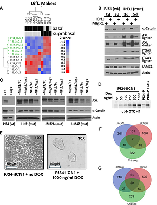 NOTCH1 Acts as a Tumor Suppressor That Induces Early Differentiation in Head and Neck Cancer