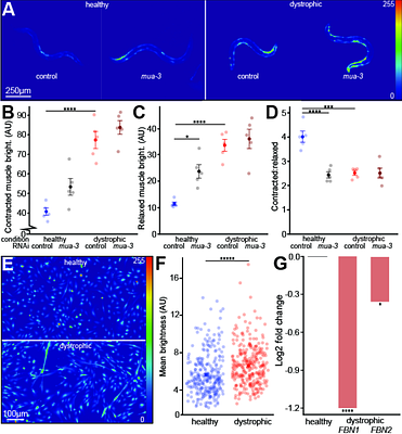 Fibrillin-Related Proteins Control Calcium Homeostasis in Dystrophic Muscle Across Species