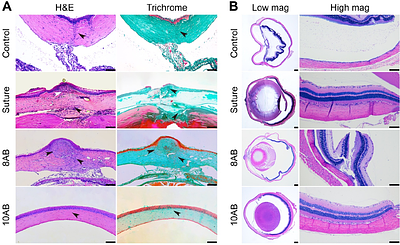 Genetically Programmable Adhesive Protein Hydrogels for Sealing Perforating Corneal Trauma
