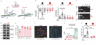 Wnts are endothelial cell-derived PKD1/PKD2-dependent autocrine/paracrine vasodilators
