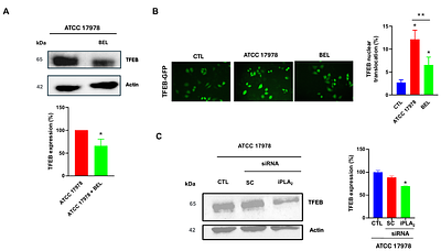 OmpA controls intracellular survival of Acinetobacter baumannii through TFEB activation and lysosomal remodeling