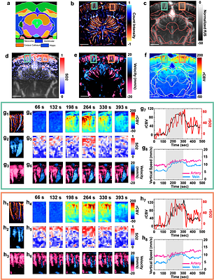 Dissecting Multiparametric Cerebral Hemodynamics using Integrated Ultrafast Ultrasound and Multispectral Photoacoustic Imaging