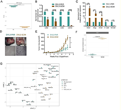 NNMT is a biomarker of prostate cancer cells with a mesenchymal phenotype and induces sensitivity to metabolic agents