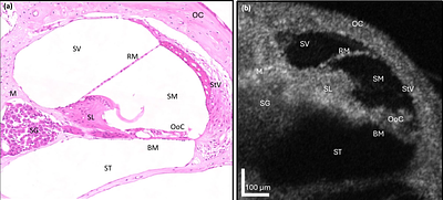 Application of Spectral Domain Optical Coherence Tomography To Guide Cochlear Implant Electrode Array