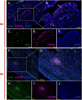 CXCR6 marks polyfunctional effector CD4 T cells required for anti-Chlamydia immunity in the female reproductive tract