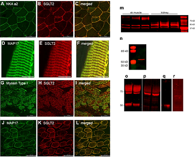 Insulin-independent glucose uptake in skeletal muscle by coupled SGLT and Na,K-ATPase transport