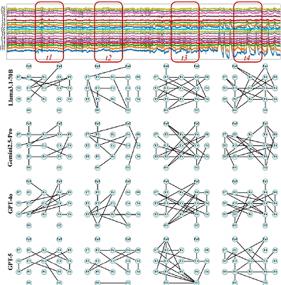 LLM as Clinical Graph Structure Refiner: Enhancing Representation Learning in EEG Seizure Diagnosis