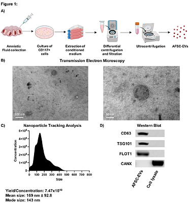 Amniotic fluid stem cell extracellular vesicles promote lung development via TGF-beta modulation in a fetal rat model of oligohydramnios