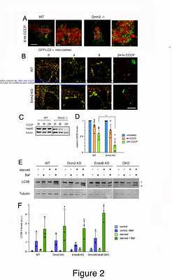 Dynamin-2 promotes Atg9A retrieval from phagophores during autophagy.