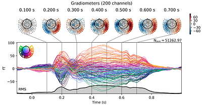 BCCWJ-Brain: A Multi-Modal fMRI, MEG, and EEG Dataset of Naturalistic Japanese Reading