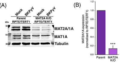 Genome-wide CRISPR/Cas9 screen identifies MAT2A as a critical host factor for BK Polyomavirus
