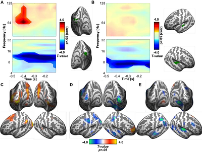 Two senses, one rhythm: Pre- and post-stimulus neural states predict perceived audio-visual synchrony