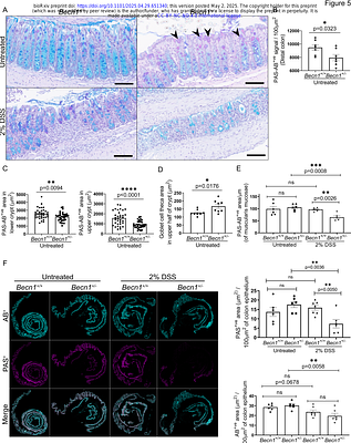 Sufficient levels of BECLIN1 are required for intestinal epithelial cell homeostasis and protection against unwanted intestinal inflammation