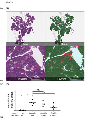 An Fc-SPINK1 fusion protein inhibits pancreatic inflammation in a mouse model