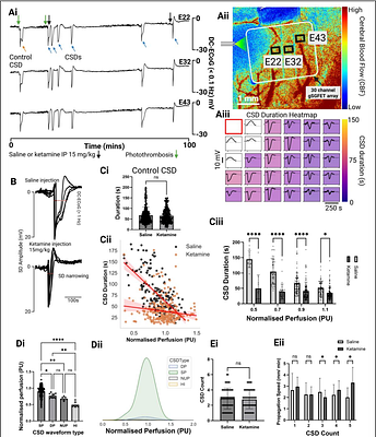 Graphene Micro-transistor Arrays Reveal Perfusion-Dependent Electrophysiological and Haemodynamic Signatures of Cortical Spreading Depolarizations in Ischaemic Stroke