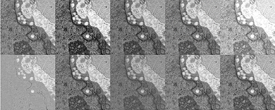 Towards Generalizability and Robustness in Biological Object Detection in Electron Microscopy Images