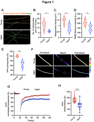 Impairment in axonal translation and cytoplasmic viscosity during aging in sensory neurons