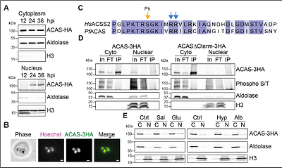 Nuclear acetyl-CoA production by acetyl-CoA synthetase enables dynamic histone acetylation and gene expression in Plasmodium falciparum
