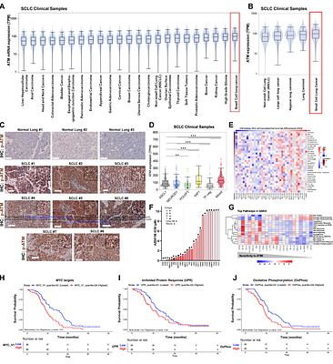 ATM functions as a rheostat of metabolic stress in small-cell lung cancer