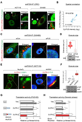 Aberrant 3'UTR splicing drives FUS-dependent mRNA condensates and prevents β-catenin from adherens junctions to promote cancer aggressiveness