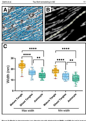 Ultrastructural remodelling of tau fibrils during ghost tangle formation in Alzheimer's disease brain