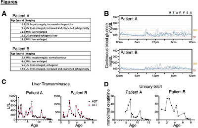 Cell modeling and rescue of a novel non-coding genetic cause of Glycogen Storage Disease IX