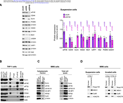 eIF4E and Ezrin cooperate in pseudopods to drive a localized migratory translation program in acute myeloid leukemia