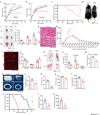 Muscle March5 restrains an ATF4-GDF15 endocrine stress axis that modulates feeding and body composition
