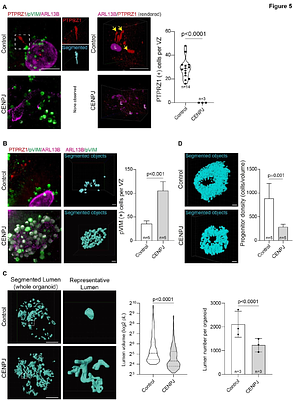 Quantitative 3D cytoarchitecture of human brain organoids using light-sheet microscopy