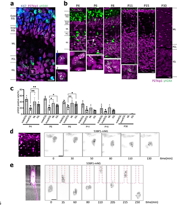 Neuronal migration induces DNA damage in developing brain