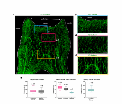 Volumetric imaging and single-cell RNAseq atlases identify cellular mechanisms of human dental pulp response during tooth decay progression