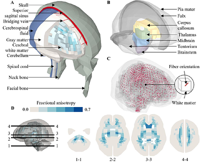 The influence of tension-compression switches on brain anisotropic modelling
