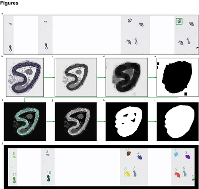 Automated Quantitative Assessment of Elastic Fibers in Verhoeff-Van Gieson-Stained Mouse Aorta Histological Images