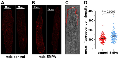 The sodium/glucose cotransporter 2 inhibitor empagliflozin is a pharmacological chaperone of cardiac Nav1.5 channels