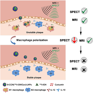 Theranostic multifunctional lipid nanoparticles containing curcumin for integrated imaging and stabilizing vulnerable atherosclerotic plaques through an "eat-me" signal
