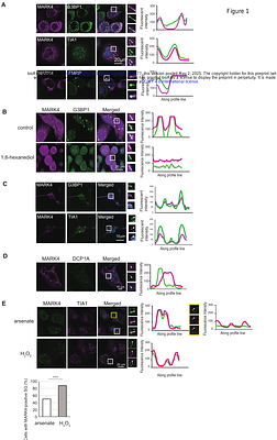 MARK4 enhances stress granule formation and increases tau accumulation