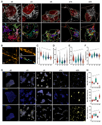 Stage-resolved iPSC-to-motoneuron differentiation: Metabolic switch & mitochondrial remodeling