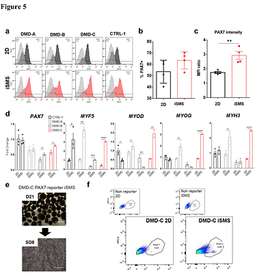 iPSC-derived skeletal muscle spheroids for Duchenne Muscular Dystrophy modeling