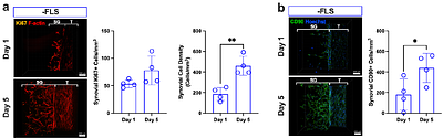 A human synovial tendon-on-a-chip models key features of peritendinous adhesions and offers a new approach methodology for testing anti-fibrotic drugs