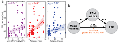 Myogenic artifacts masquerade as neuroplasticity in the auditory frequency-following response (FFR)