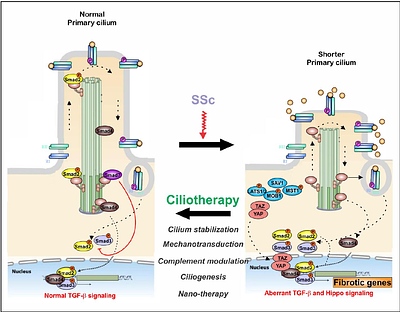 Imbalance of Ciliary Programs Drives Fibroblast Differentiation and Fibrotic Signaling in Systemic Sclerosis