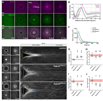 Reversible Actin modifications by Mical and SelR regulate dynamic actomyosin ring functions during cell wound repair