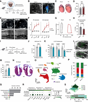 Tricuspid valve regurgitation accelerates heart failure via a cardio-intestinal innate immune circuit