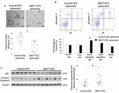 Epithelial QKI Protects Against Emphysema by Maintaining Mitochondrial Integrity