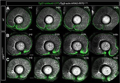 Genetically interacting mutations and mechanical stress affect the stochasticity of developmental eye defects in yap1 mutants