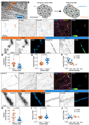 N-cadherin orientational order decreases with mechanical load at cardiomyocyte adherens junctions