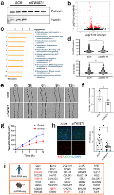 TWIST1 drives endothelial-to-mesenchymal-transition to stabilize atherosclerotic plaques